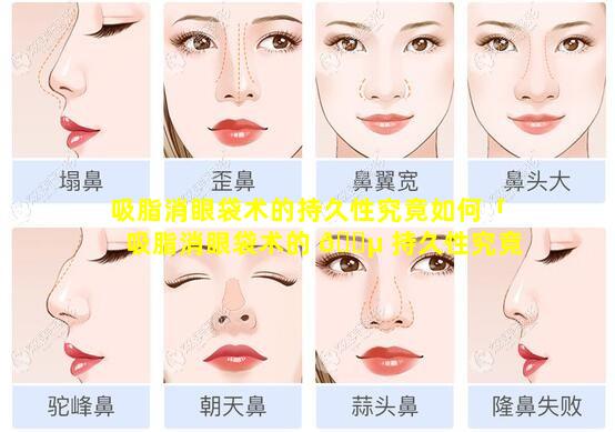 吸脂消眼袋术的持久性究竟如何「吸脂消眼袋术的 🐵 持久性究竟如 🌷 何呢」